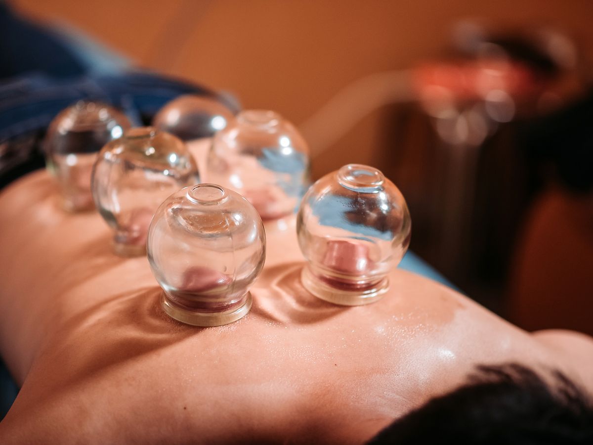 asian-chinese-male-patient-receiving-cupping-royalty-free-image-1675977718
